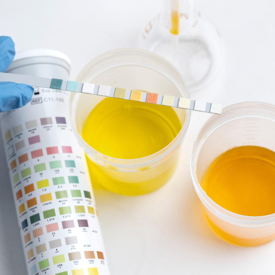 O que diz a cor da urina?